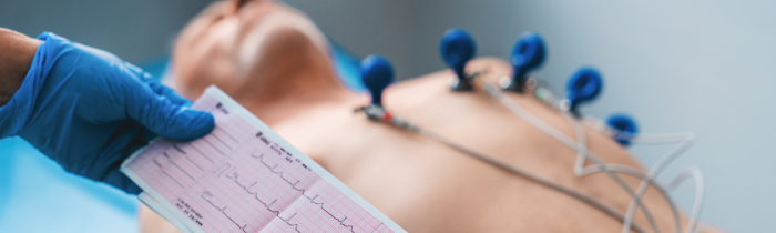 ECG Diagnostic Services