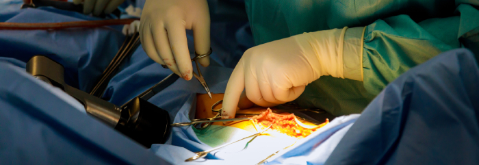 General & Laparoscopic Surgery